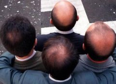 脂溢性脫發(fā)是怎么導(dǎo)致的